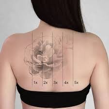 What Is Laser Tattoo Removal and How Does It Work?